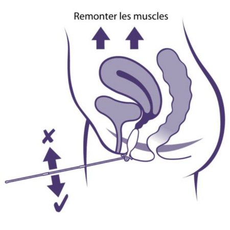 vignette Periform+ Sonde Vaginale Blanche Reeducation